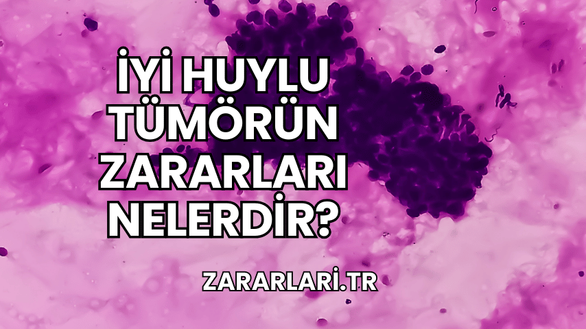 İyi Huylu Tümörün Zararları Nelerdir?