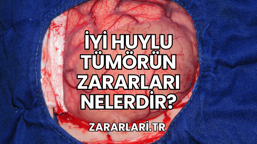 İyi Huylu Tümörün Zararları Nelerdir?