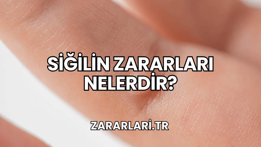 Siğilin Zararları Nelerdir?