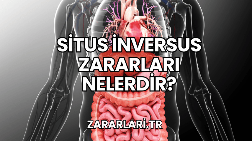 Situs İnversus Zararları Nelerdir?