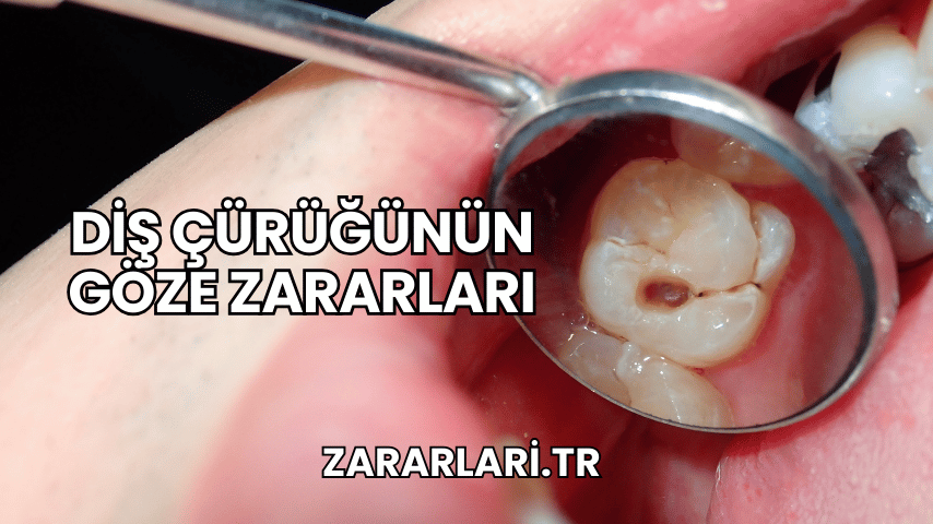 Diş Çürüğünün Göze Zararları