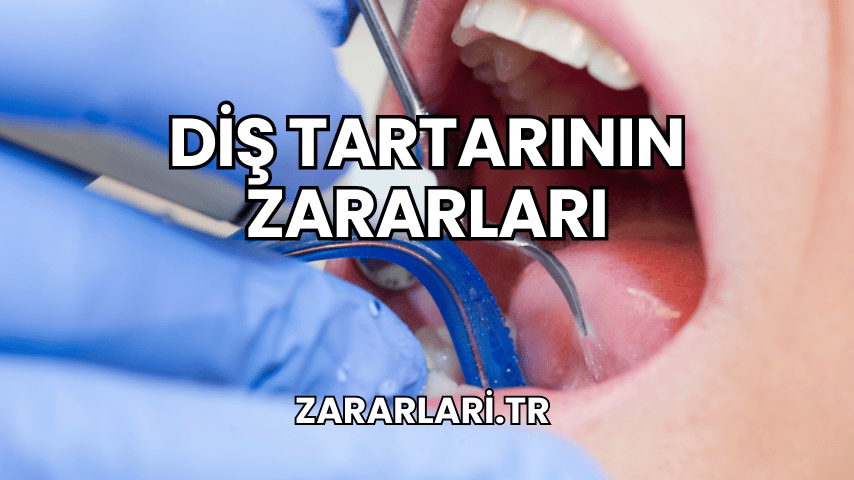 Diş Tartarının Zararları