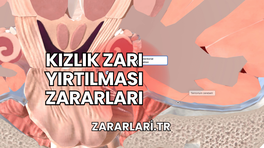 Kızlık Zarı Yırtılması Zararları